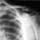 Xray Lab Sevices Pompton Plains
