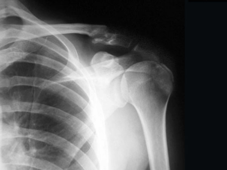 Labs and Xray